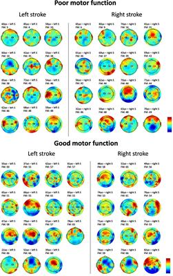 Using Brain Oscillations and Corticospinal Excitability to Understand and Predict Post-Stroke Motor Function
